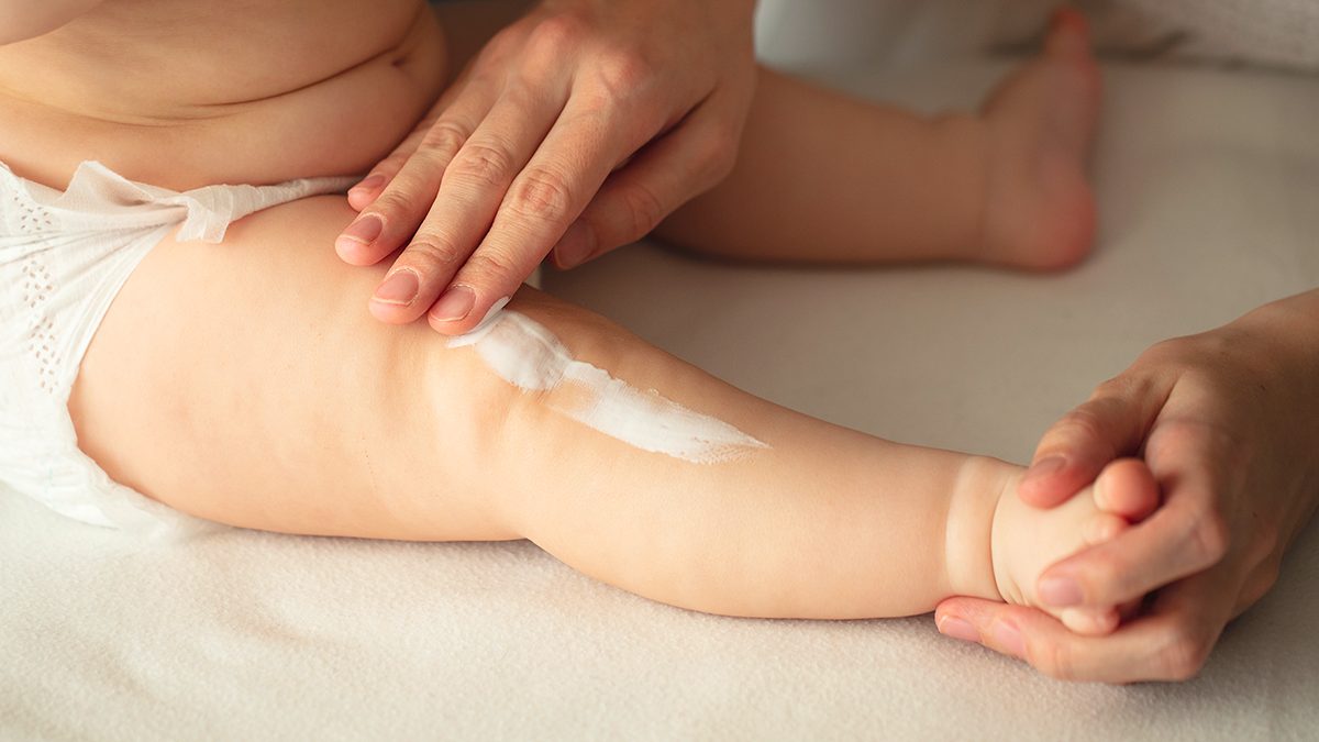 Como tratar a pele atópica em crianças e bebés e quais os melhores cremes a utilizar 1 Como tratar a pele atópica em crianças e bebés e quais os melhores cremes a utilizar