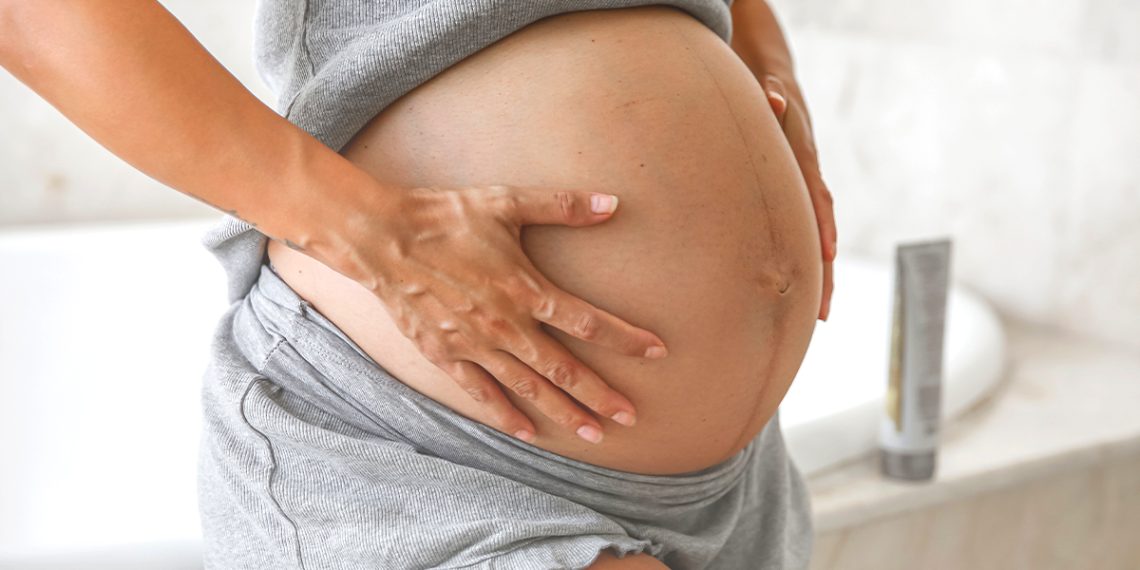 ACEITE ALMENDRAS EMBARAZO