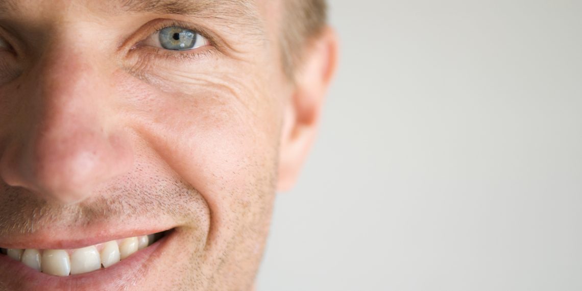 As rugas não surgem só com o envelhecimento: conhece os tipos e como tratá-las 20 TIPOS DE ARRUGAS