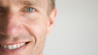 As rugas não surgem só com o envelhecimento: conhece os tipos e como tratá-las