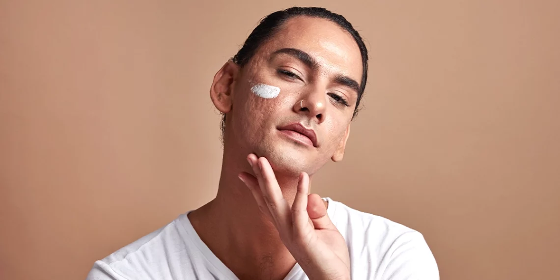 Manchas faciais: o que as causa e como podes tratá-las 26 TIPO MANCHAS CARA