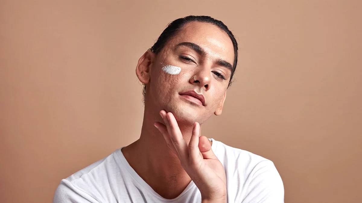 Manchas faciais: o que as causa e como podes tratá-las 1 Manchas faciais: o que as causa e como podes tratá-las