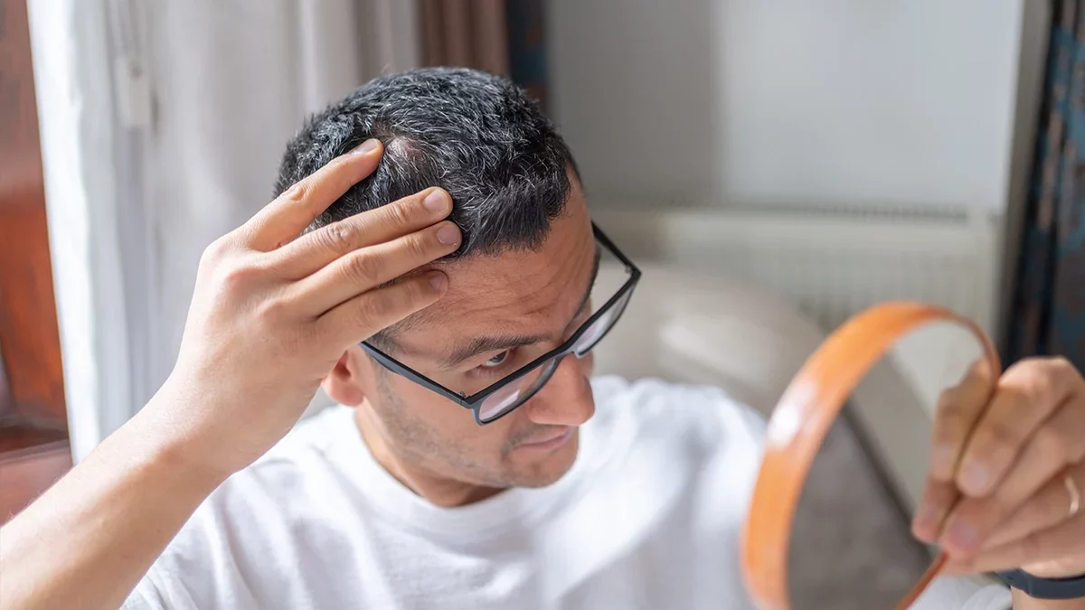 Queda de cabelo: quando consultar um especialista
