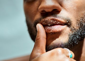 Estos son los mejores exfoliantes para labios