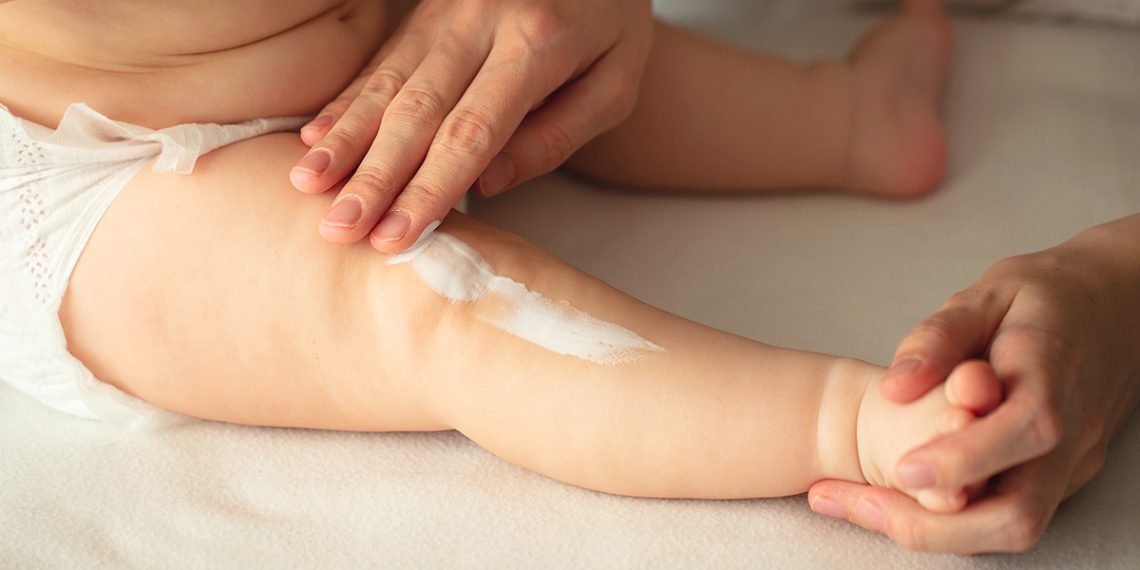 Necesitas las mejores cremas para tratar la piel atópica en niños y bebés