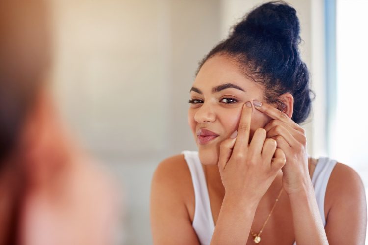 Te contamos cómo maquillar la piel con acné