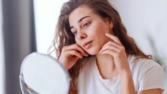 Qué es y por qué aparece el acné conglobata, uno de los más severos para la piel según los expertos