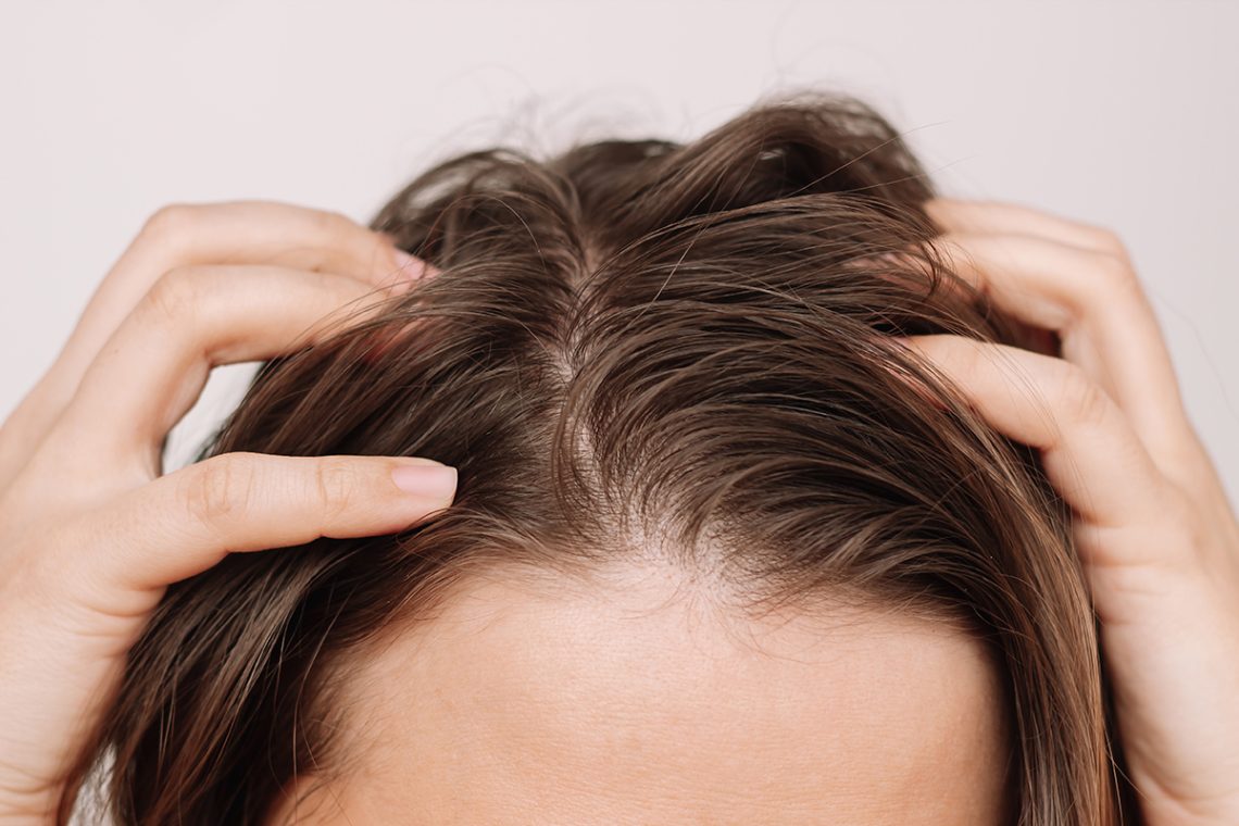 Los 10 mejores champús para cabello graso de 2025