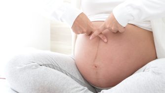 ¡Cuidado! Si estás embarazada, las cremas y cosméticos que NO debes aplicar