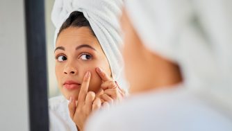 Skin Purge: Que es y que beneficios tiene para mi piel