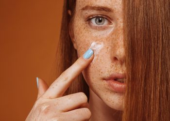 Resolvemos las dudas acerca de lo que es un melasma