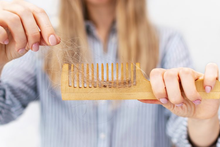 Te contamos cómo prevenir caída de pelo por estrés