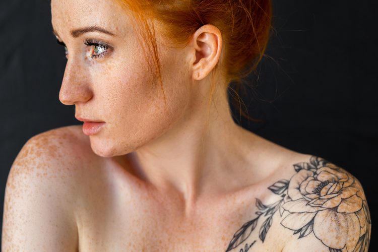 Granos en tatuajes: por qué salen