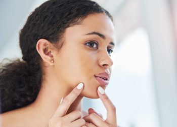 Granos en los labios: cómo tratarlos según la causa