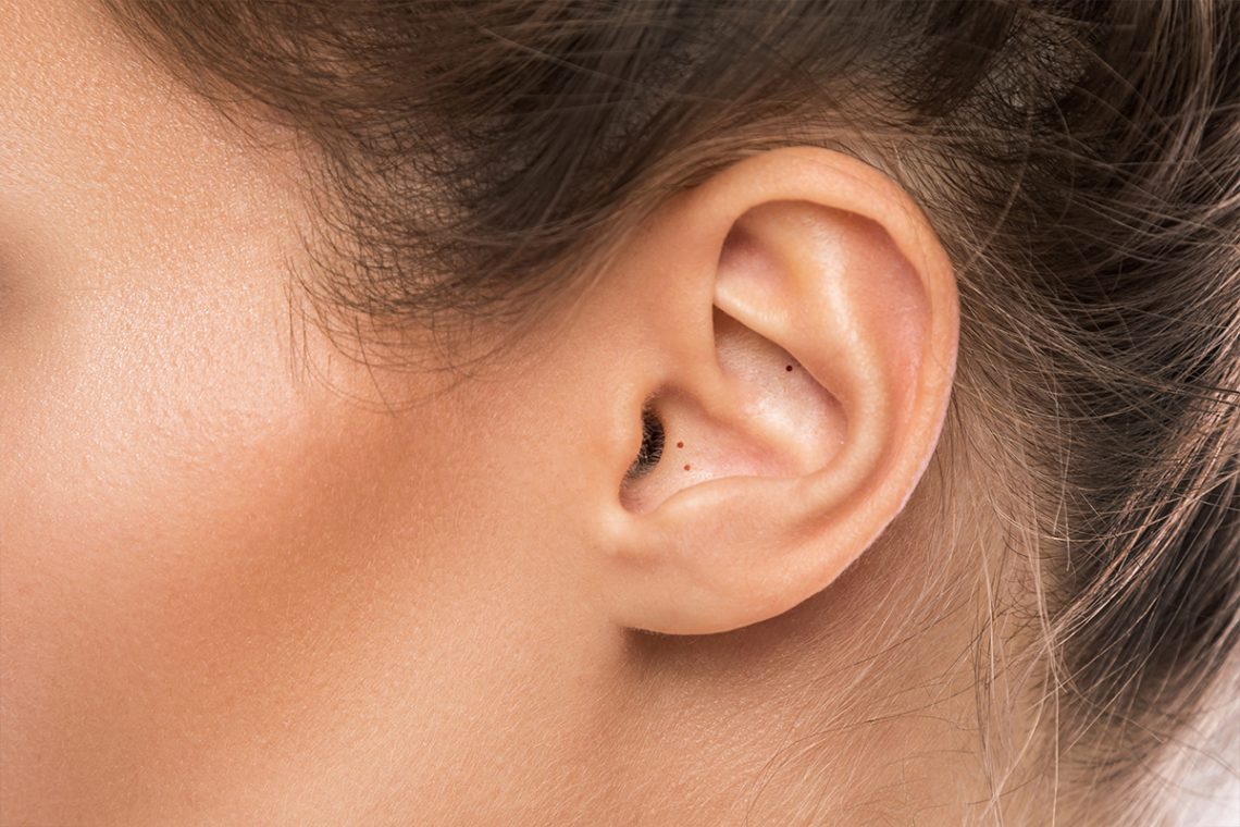 Puntos negros de las orejas: cómo eliminarlos