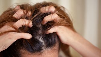 Las principales diferencias entre la caspa grasa y la caspa seca