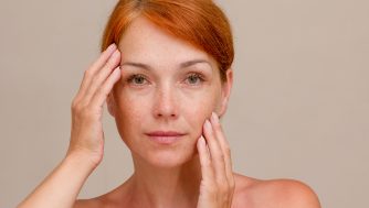 ¿Qué son las ojeras pigmentadas y cómo puedo eliminarlas?