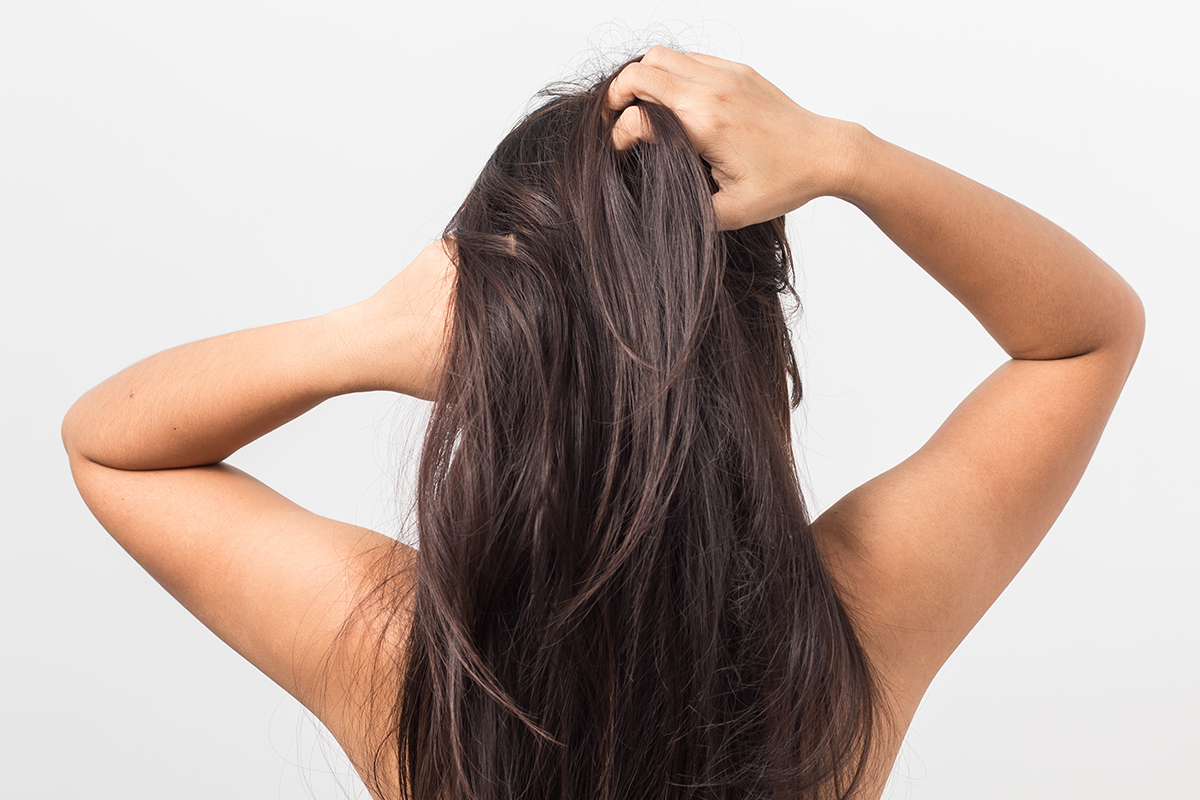 Me Duele El Cuero Cabelludo Al Mover El Pelo