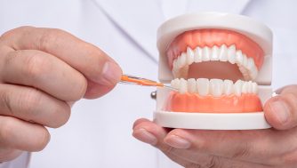 Las 6 mejores alternativas al hilo dental