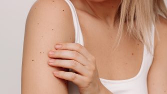Los 4 mejores productos para cuidar una piel con lunares