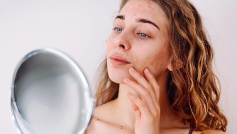 Si tienes psoriasis en la cara, así es cómo debes tratarla