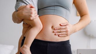 Si tienes una cicatriz por la cesárea, estos son los mejores cuidados que necesitas (según expertos)