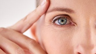 Los 10 mejores consejos y tratamientos para prevenir las patas de gallo