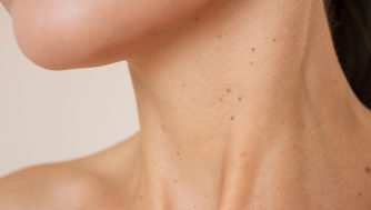 Los diferentes tipos de verrugas y cómo tratar cada una de ellas