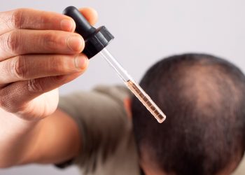 activos similares minoxidil cabello